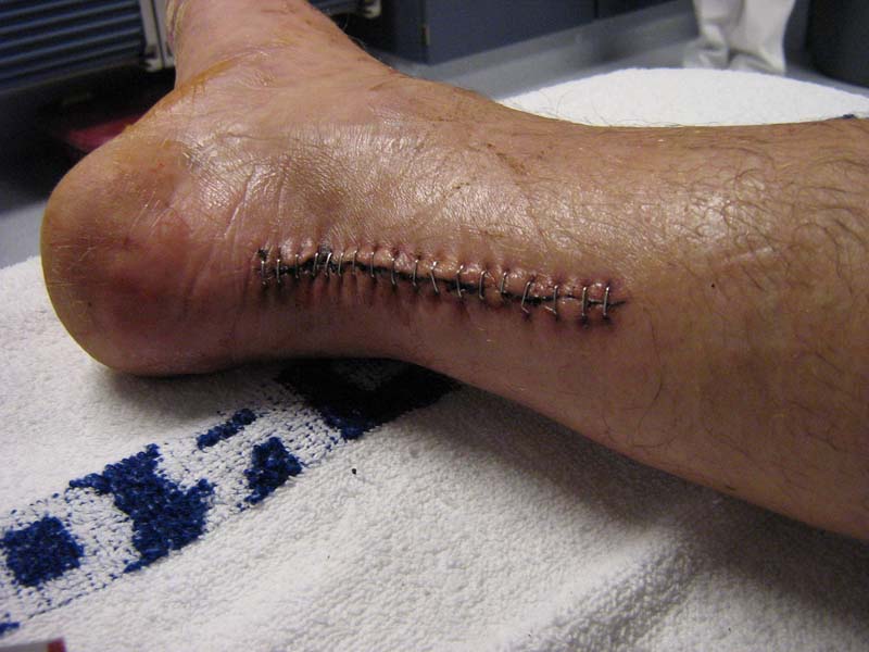 Click image for larger version

Name:	img_1510_web.jpg
Views:	1347
Size:	82.4 KB
ID:	355562